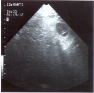 Marti's ultrasound